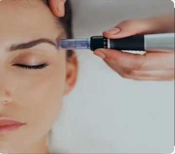 Glow by Shay microneedling